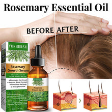 Load image into Gallery viewer, Rosemary Hair Growth Serum - Sulphate and Paraben-Free
