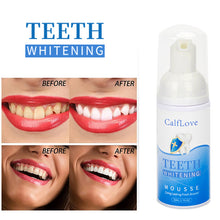 Load image into Gallery viewer, Teeth Whitening Mousse
